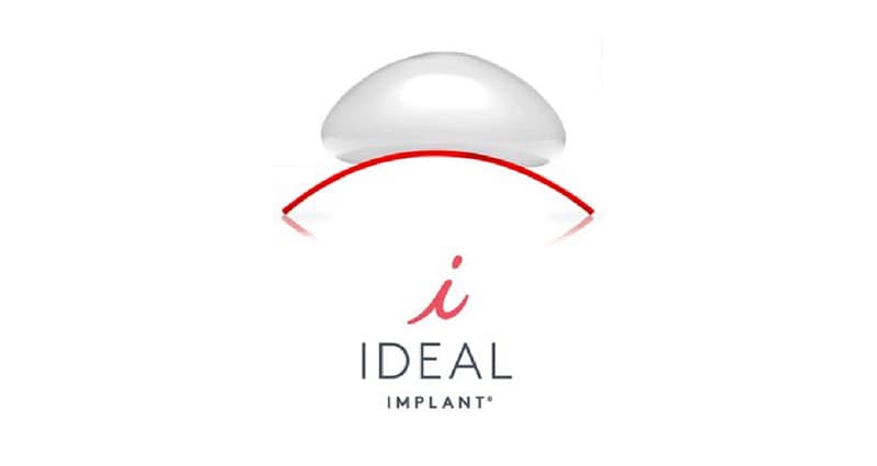 Ideal Implants logo