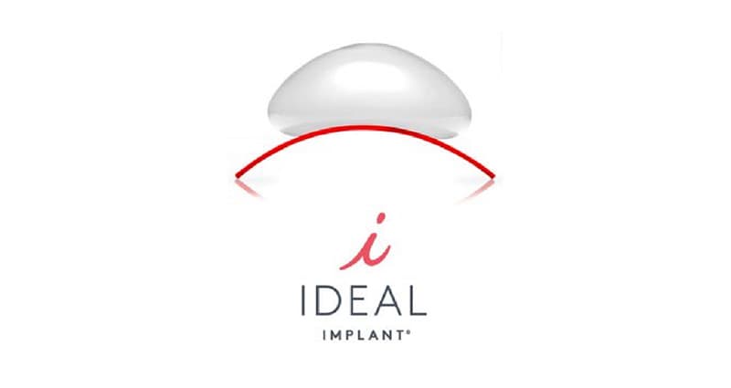 Ideal Implants logo