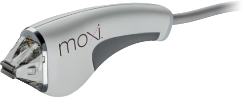 Moxi laser skin rejuvenation device