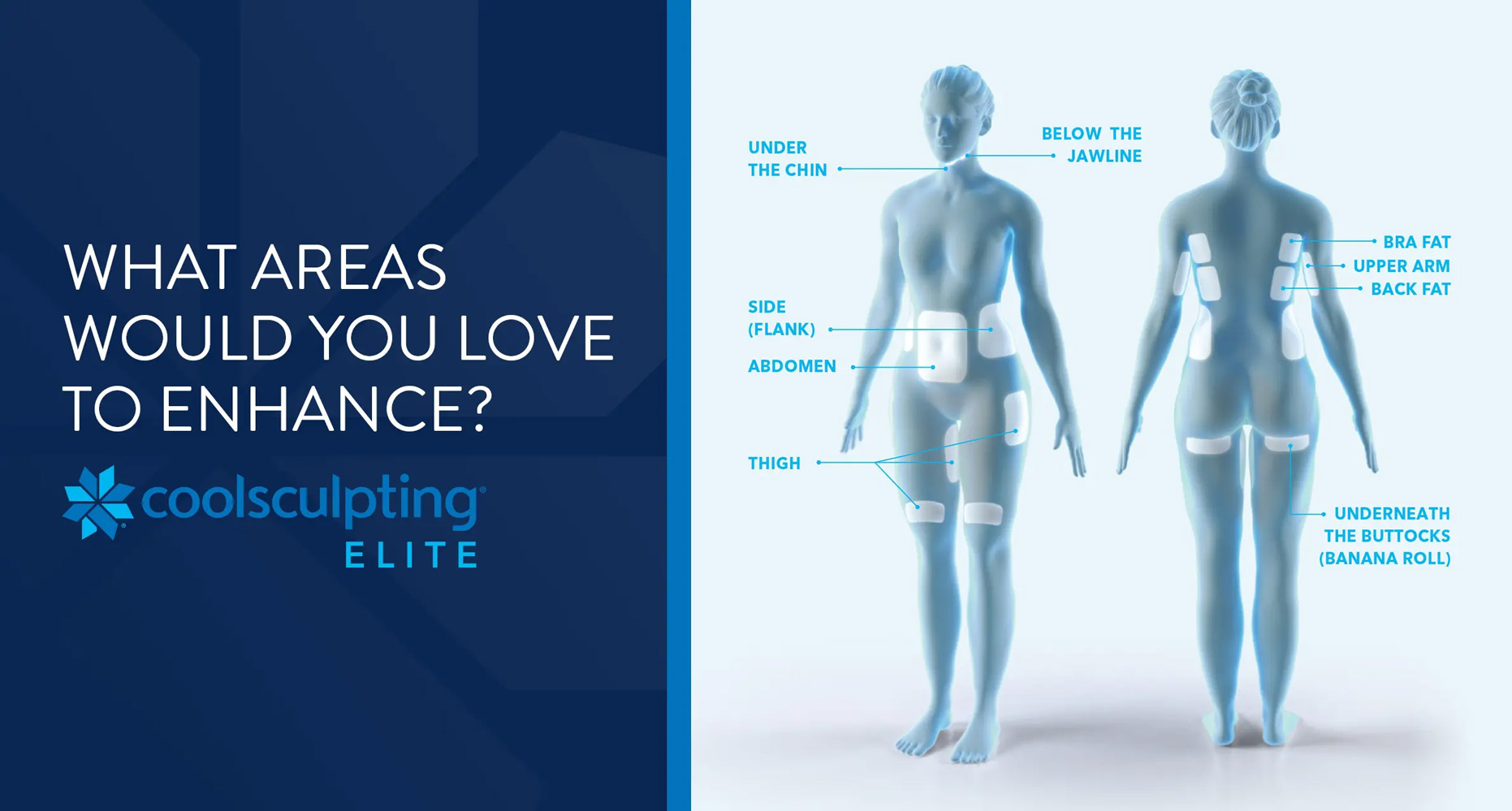 CoolSculpting® Upper Flanks