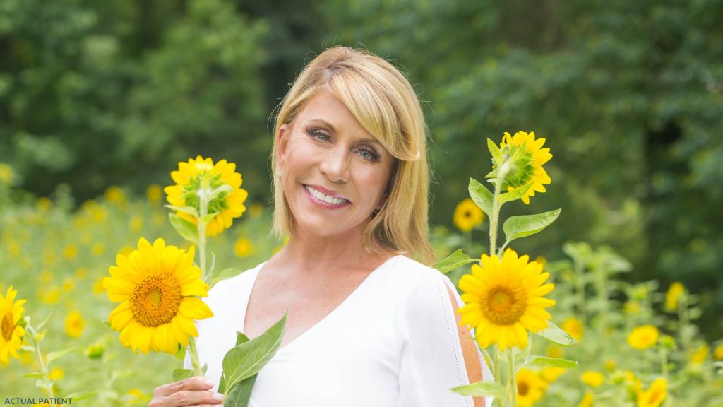 Mature woman smiling holding sunflower (actual patient)