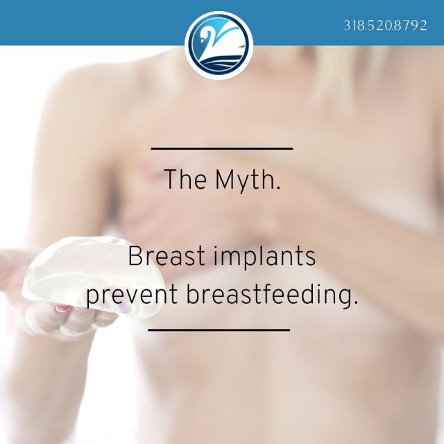 Can you still breastfeed after a breast augmentation?