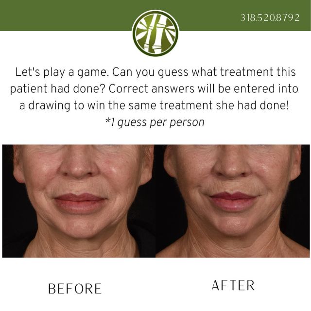 Comment and WIN! We want to see if you can guess what treatment this patient received. All correct answers will be entered into a drawing to win the very same treatment! Only 1 guess per person.