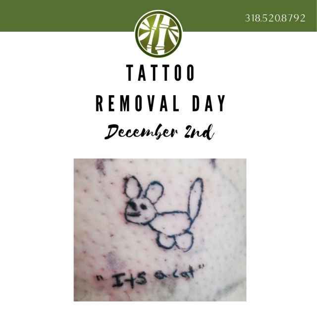 Tattoo removal day is coming up this Friday, December 2. Call today to schedule your appointment! Don't forget our gift card sale is still going on until the end of the day! Go to our website and purchase before they're gone! The link is in our story 😉

#jademedispa #medispa #selfcare #tattooremoval #tattooremovalday #lasertattooremoval #beauty #aesthetics #shreveport #louisiana