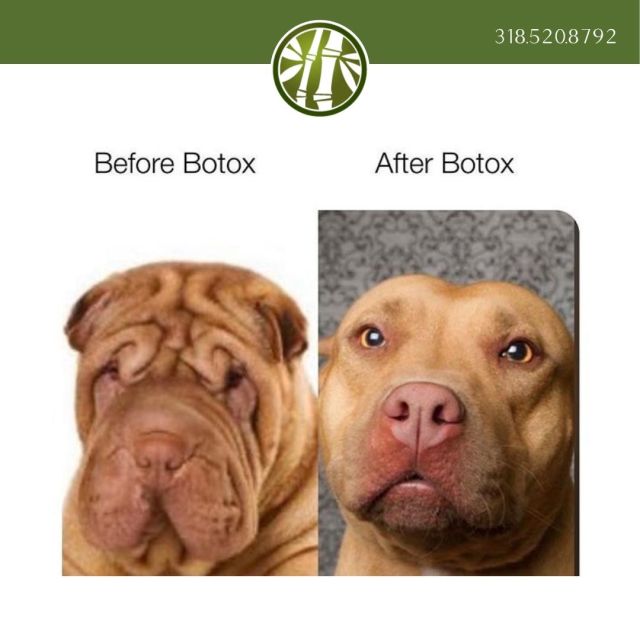 Botox is just one of the many neurotoxins we offer at Jade MediSpa. No matter which neurotoxin you choose, you'll leave looking glamorous and wrinkle free😉

#neurotoxin #injectables #jademedispa #wrinklefree #shreveport #louisiana