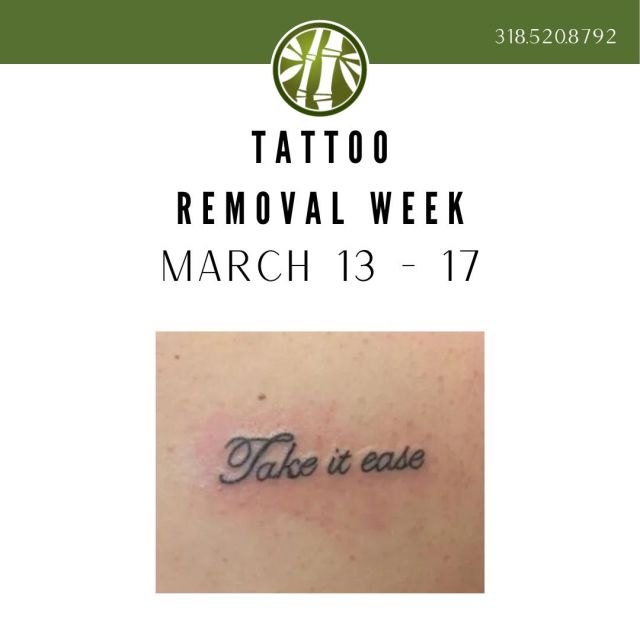 Surprise! Here's another month where you have a full week to schedule those laser tattoo removal appointments! Take it easy--call and schedule today!

#tattooremoval #tattooremovalweek #jademedispa #takeiteasy #shreveport #louisiana