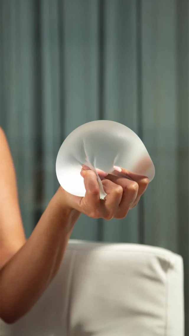 When it comes to your safety, Motiva® sets the standard.
 0.5% capsular contracture¹
  0.9% infection¹
  0.6% rupture¹
  97.1% patient satisfaction²* | 99% surgeon satisfaction²*

Motiva Implants® are designed to deliver results you can feel good about - inside and out.

Thinking about Motiva®? Let’s chat! Book your consultation today.

The patient/stories highlighted here are only examples of patient results. Individual results may vary and are not guaranteed.

#MotivaUSA #MotivaImplants #PlasticSurgeryJourney #BoardCertifiedSurgeon @motiva_usa

*Primary Augmentation Cohort, 5-Year CORE Study
1. Establishment Labs® Holdings Corp. Establishment Labs® Notes Presentation of 5-Year Results from Motiva® U.S. IDE Study at the Aesthetics MEET 2025. https://investors.establishmentlabs.com/press-releases/press-releases-details/2025/Establishment-Labs-Notes-Presentation-of-5-Year-Results-from-Motiva-U-S--IDE-Study-at-The-Aesthetic-MEET-2025/default.aspx. Published March 20, 2025. Accessed March 20, 2025
2. Caroline Glicksman, Andrew Wolfe, Patricia McGuire, The Study of the Safety and Effectiveness of Motiva SmoothSilk® Silicone Gel-Filled Breast Implants in Patients Undergoing Primary and Revisional Breast Augmentation: Three-Year Clinical Data, Aesthetic Surgery Journal, 2024;, sjae134, https://doi.org/10.1093/asj/sjae134