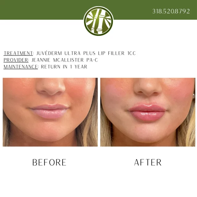 Get her the lips she will love, for Christmas! Black Friday thru Cyber Monday, take advantage of our BOGO gift card special to get the best deals on your future services! Spend $100 on a gift card, get a $50 gift card FREE. Spend $1000 on a gift card, get a $500 gift card FREE! Just go to our webpage and purchase at our shop on-line.