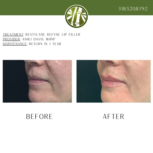 Pssst... No one has to know. Get the lips!