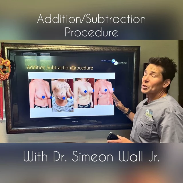What is an addition subtraction procedure? Find out with Dr. Simeon Wall Jr. 

To schedule a consultation with Dr. Wall Jr., TEXT "consult with SWJ" to 318.523.2722