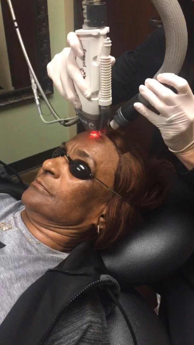 Fraxel Laser 15% off all packages of 3 or more sessions, PLUS receive a complimentary SPF or serum to support and protect your results between treatments! This special is available for all laser treatments through February 28th. Pre purchase now to use at a later time! TEXT "Fraxel Me" to 318.523.2722 for more information.